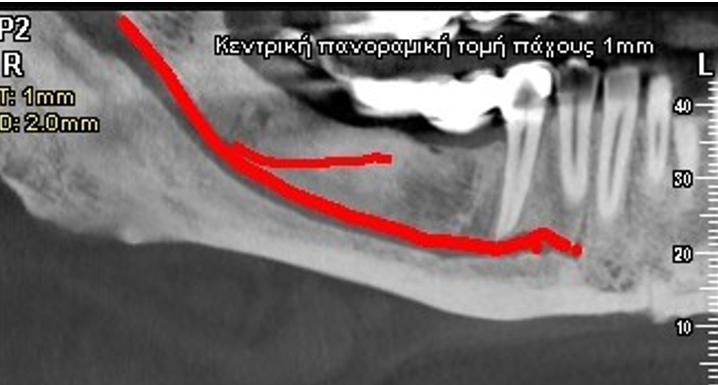 CBCT PANORAMIC