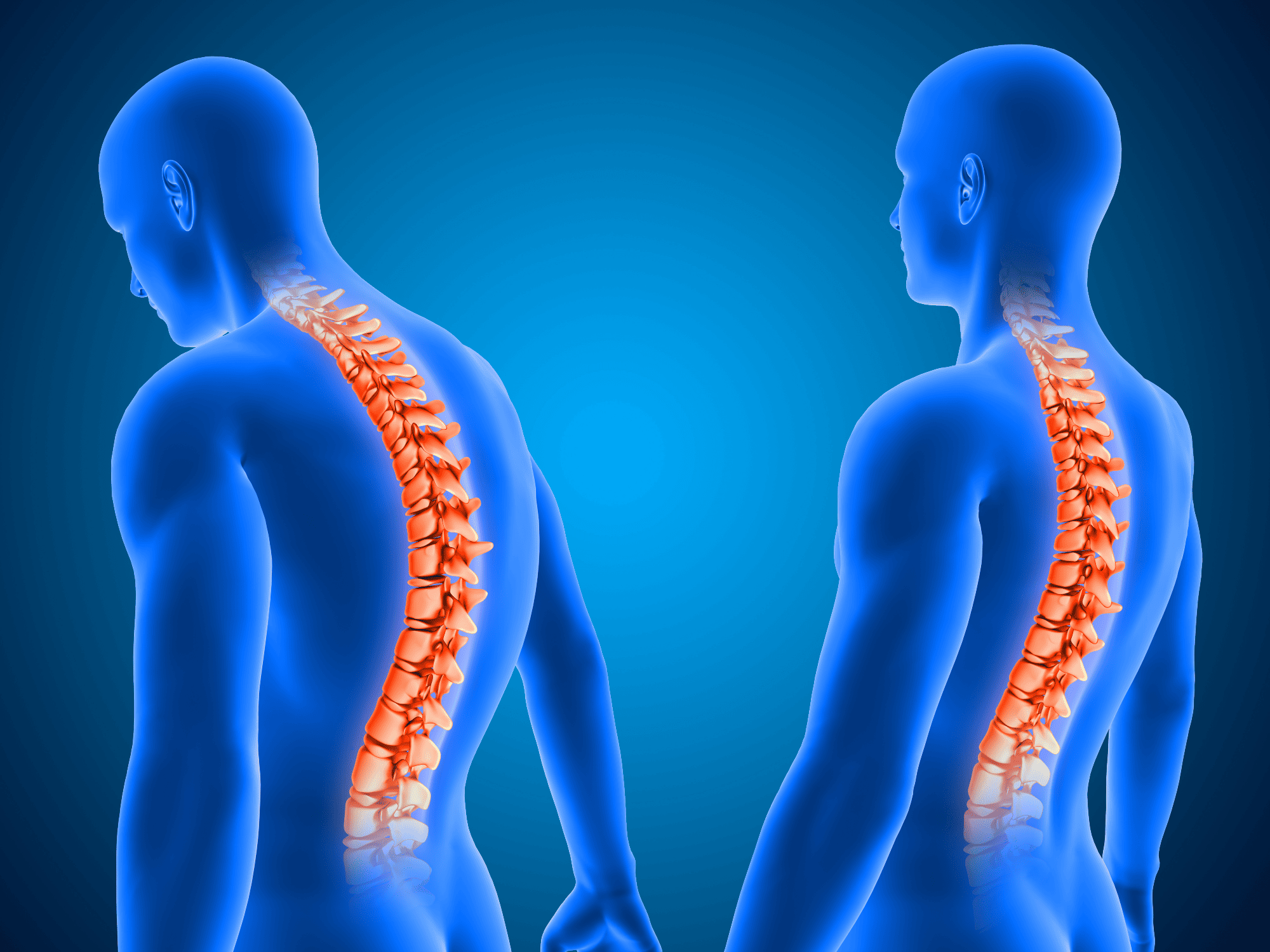 full spine